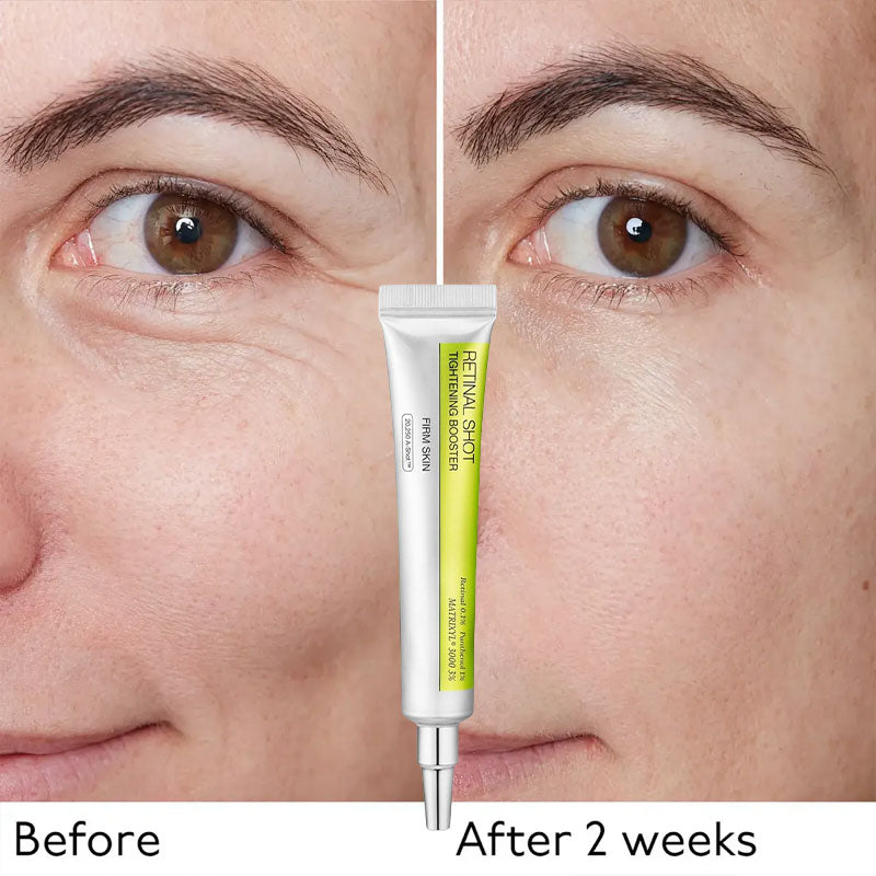 Retinol Firming Eye Cream
