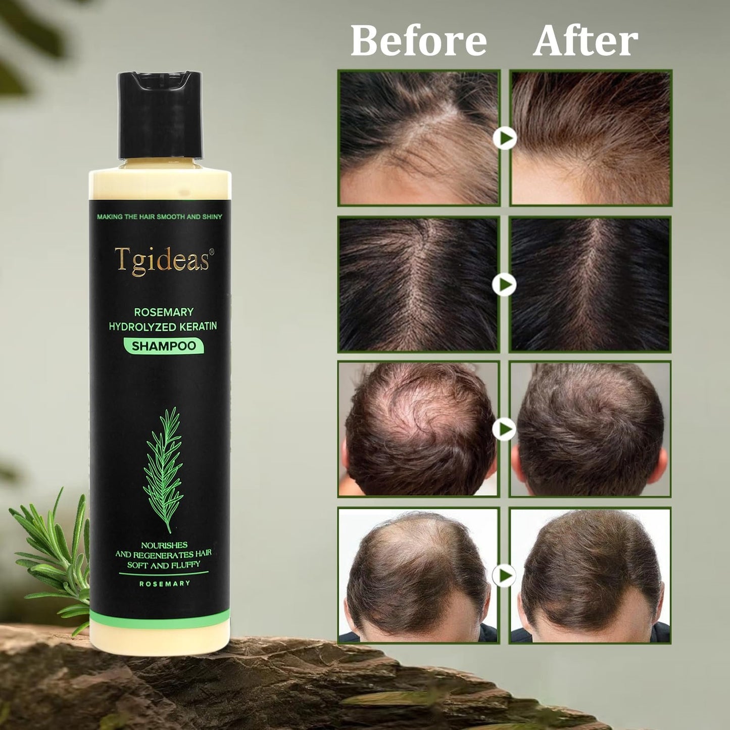 Tgideas Organic Rosemary Hair Growth Shampo