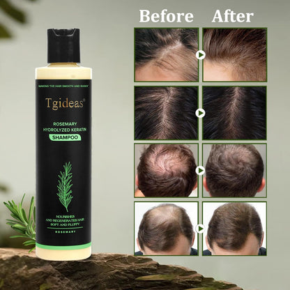 Tgideas Organic Rosemary Hair Growth Shampo