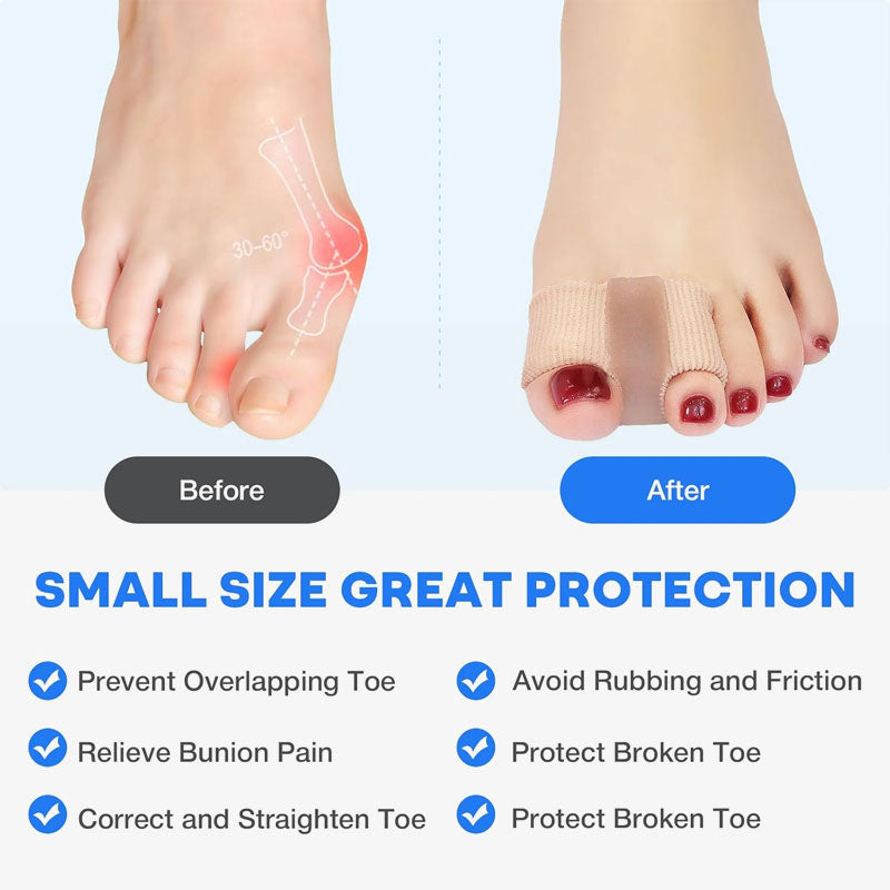 Toe separator & Hallux valgus corrector