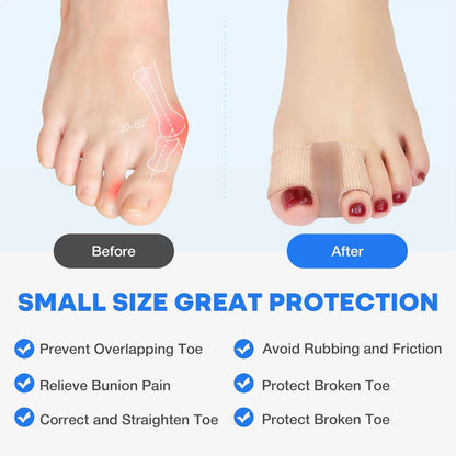 Toe separator & Hallux valgus corrector